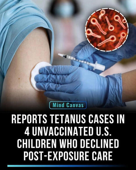 Tetanus Infections in Unvaccinated Individuals: Importance of Timely Medical Treatment | S.P SANTHOSH KUMAR NAIDU posted on the topic | H&eacute;sitations Vaccinales: Observatoire HESIVAXs | Scoop.it