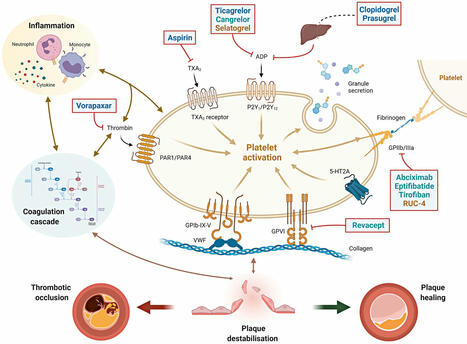 Antiplatelet therapy after percutaneous coronary intervention  | Neurovascular Intervention | Scoop.it