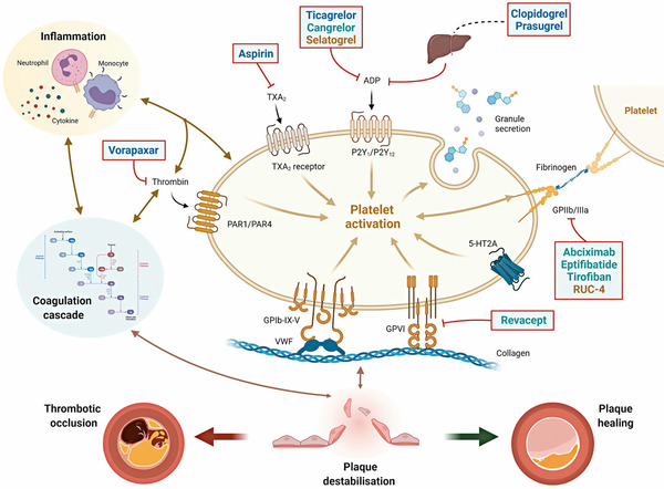 Antiplatelet therapy after percutaneous coronary intervention  | Interventional Cardiology | Scoop.it