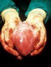 10 Unbelievable Organ Transplant Stories | Science News | Scoop.it