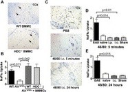 ScienceDirect.com - Journal of Autoimmunity - Mast cell activation and neutrophil recruitment promotes early and robust inflammation in the meninges in EAE | NeuroImmunology | Scoop.it