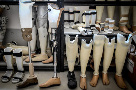 Creating 3D-printed prosthetic limbs for Ugandan children | Amazing Science | Scoop.it