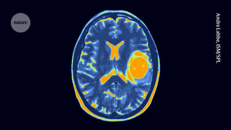 This kids&rsquo; brain cancer is incurable &mdash; but immune therapy holds promise - Nature | Genetic Engineering in the Press by GEG | Scoop.it