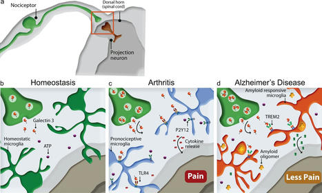 Mouse study suggests pain not perceived in the same way in people with Alzheimer's disease | Alzheimer y más (Boletín nº 69) | Scoop.it