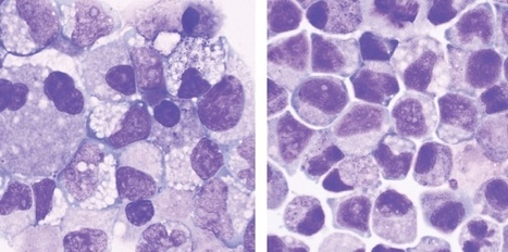 D&eacute;couverte d'une mol&eacute;cule qui multiplie les cellules souches | Bio&eacute;thique & Procr&eacute;ation | Scoop.it