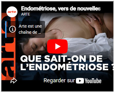 Endom&eacute;triose : le traitement par ultrasons focalis&eacute;s devient un standard th&eacute;rapeutique | Actualit&eacute; | Hospices Civils de Lyon - CHU de Lyon | Politiques d'&eacute;galit&eacute; et non discrimination | Scoop.it