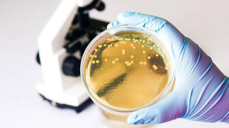 Les analgésiques augmenteraient la résistance aux antibiotiques | actualités VIH, hépatites, IST, santé sexuelle | Scoop.it