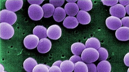 IBM Research produces bacteria-killing "ninja polymers” | Longevity science | Scoop.it