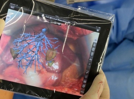 Fraunhofer iPad app guides liver surgery through augmented reality | Is the iPad a revolution? | Scoop.it