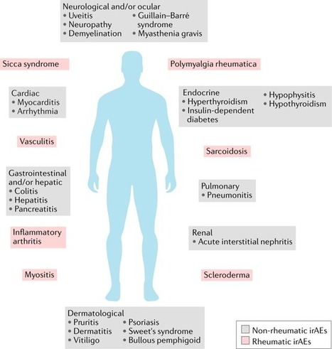 Rheumatic immune-related adverse events from cancer immunotherapy | Rheumatology-Rhumatologie | Scoop.it