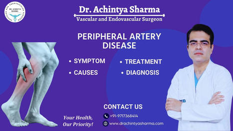 How to Manage Peripheral Artery Disease Symptoms | Dr. Achintya Sharma - Vascular and Endovascular Surgeon | Scoop.it