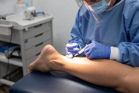 PRP Therapy Guide for Plantar Fasciitis on the Achilles Tendon | Call: 915-850-0900 | Chiropractic + Wellness | Scoop.it