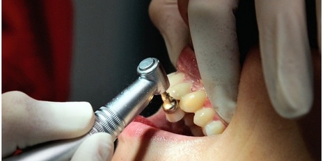 HYGIÈNE. 22.000 patients d'un dentiste rappelés pour des tests VIH | actualités VIH, hépatites, IST, santé sexuelle | Scoop.it
