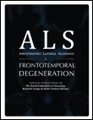 ALSUntangled review of GM604 is now available - ALS and Frontotemporal Degeneration | #ALS AWARENESS #LouGehrigsDisease #PARKINSONS | Scoop.it