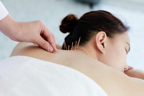 How to Find Relief from Fibromyalgia with Acupuncture | Call: 915-850-0900 | Chiropractic + Wellness | Scoop.it