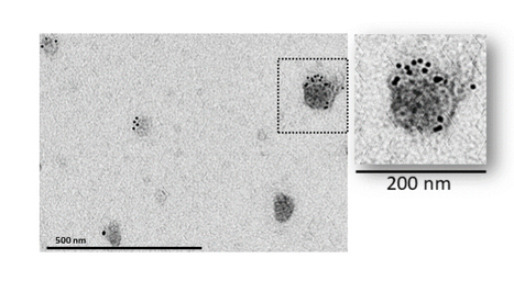 Caveolin 1β promotes the production of active human microsomal glutathione S-transferase in induced intracellular vesicles in Spodoptera frugiperda 21 insect cells | I2BC Paris-Saclay | Scoop.it