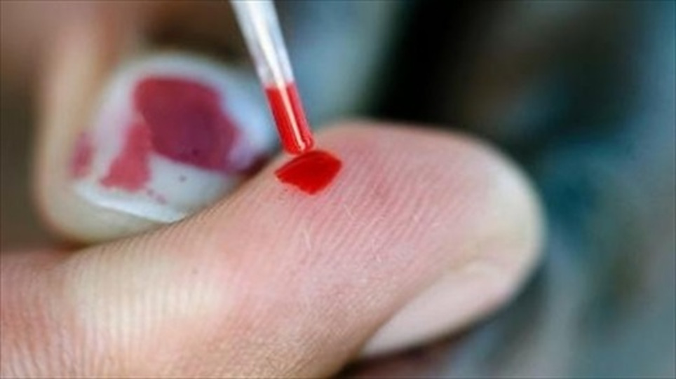 Researchers: Anti-AIDS programs help protect South Africa’s poor from infection from ‘sugar daddies’ | ReactNow - Latest News updated around the clock | Scoop.it