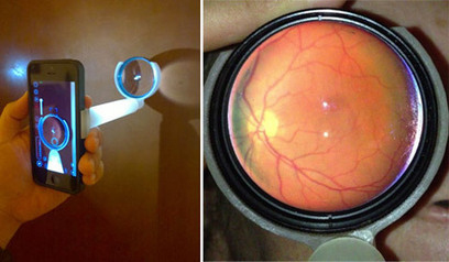 EyeGo : de l'iPhone à l'eyePhone pour les ophtalmologues | Libertés Numériques | Scoop.it
