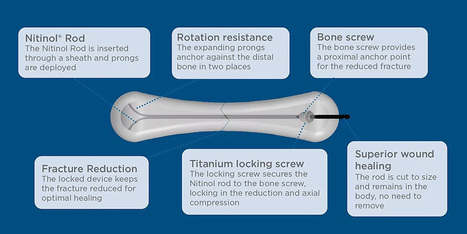 Meduloc Steps Into the Spotlight With FDA Clearance | Health Device News | Scoop.it