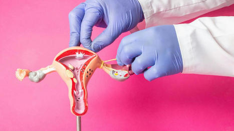 Contraception définitive : des femmes dénoncent un parcours "semé d'embûches" pour y parvenir | Famille et sexualité | Scoop.it