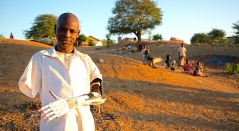 Vidéo : Des prothèses de bras imprimées en 3D à 75 euros pour le Sud-Soudan | Essentiels et SuperFlus | Scoop.it