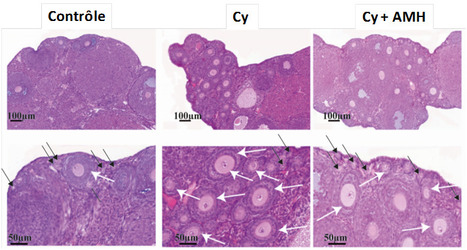 L&rsquo;hormone anti-m&uuml;ll&eacute;rienne, une promesse pour prot&eacute;ger la r&eacute;serve ovarienne au cours de la chimioth&eacute;rapie | Life Sciences Universit&eacute; Paris-Saclay | Scoop.it
