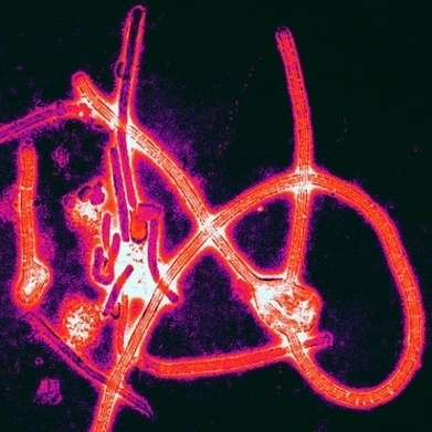 Un mal mystérieux frappe les survivants d'Ebola | Toxique, soyons vigilant ! | Scoop.it
