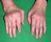 Scientists Discover New Genes Linked To Rheumatoid Arthritis | Rheumatology-Rhumatologie | Scoop.it