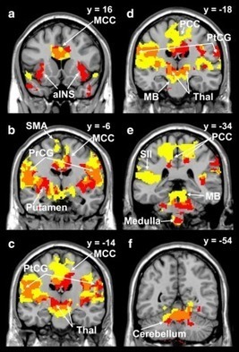 Coughing Is Linked to Perception of Temperature in the Brain | Amazing Science | Scoop.it