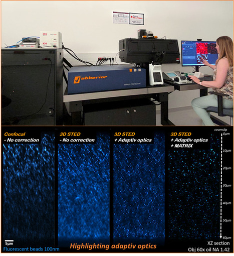 FOCUS PLATEFORME : Projet OASIS, la plateforme MIPSIT s&rsquo;est &eacute;quip&eacute;e d&rsquo;un microscope de super-r&eacute;solution STED 3D avec optique adaptative : une configuration unique en France ! | Life Sciences Universit&eacute; Paris-Saclay | Scoop.it