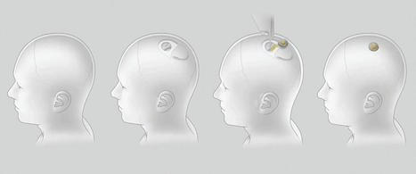 Les curieux effets secondaires des implants cérébraux façon Elon Musk | Think outside the Box | Scoop.it