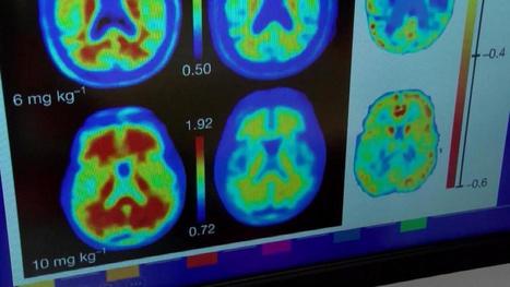 Bilingualism is good medicine for the brain | Bilingually Enriched Learners | Scoop.it