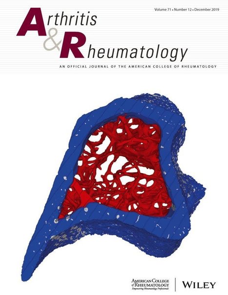 The 2019 American College of Rheumatology/European League Against Rheumatism Classification Criteria for IgG4‐Related Disease - Wallace - - Arthritis & Rheumatology | Rheumatology-Rhumatologie | Scoop.it