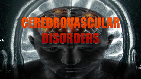 Cerebrovascular Disorders | Spine Health & Spinal Hygiene | Scoop.it