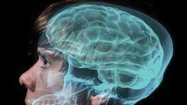 What evil lurks in the brain? German neurologist says he's found a 'dark patch' genetic source of violent behavior. | News You Can Use - NO PINKSLIME | Scoop.it