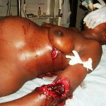 Une femme enceinte grièvement blessée à Goma le 22/11/2012 RDC Under Attack | Actualités Afrique | Scoop.it