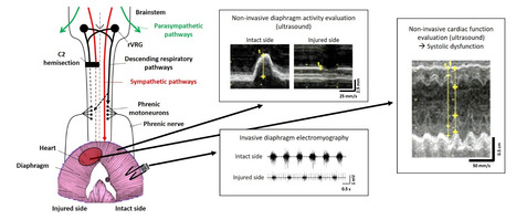 Effets d’un traumatisme médullaire haut sur les fonctions respiratoires et cardiovasculaires chez le rat | Life Sciences Université Paris-Saclay | Scoop.it