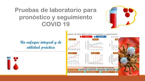 http://eliasmirandag.com.mx/wp/2020/05/01/pruebas-de-laboratorio-que-se-perfilan-para-el-seguimiento-y-pronostico-del-covid-19/ | Bioquímica, Genomica y Salud | Scoop.it