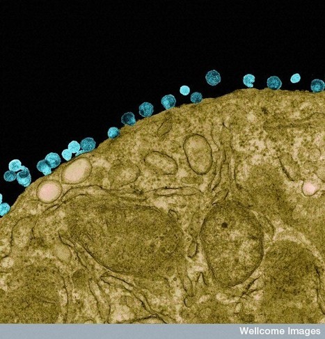 HIV particles budding from a lymphocyte - Image at The Cell: An Image Library - Image CIL:39465 | Immunology for University Students | Scoop.it