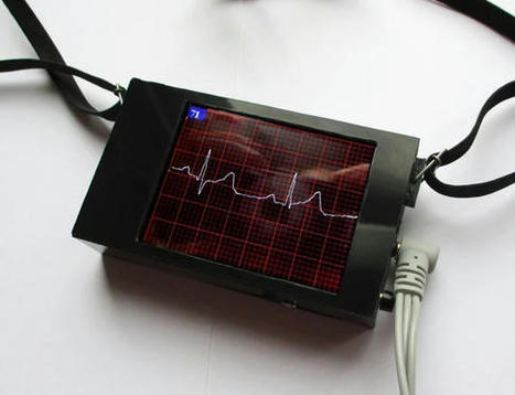 ECG Display With Arduino | Raspberry Pi | Scoo...