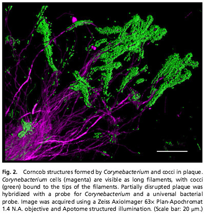 Biogeography of a human oral microbiome at the micron scale | Natural Products Chemistry Breaking News | Scoop.it