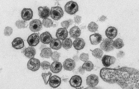 5&prime;-Leader Defects Drive Persistent HIV-1 Viremia on Long-Term ART&nbsp; | Virus World | Scoop.it