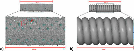 Towards biodegradable Mg-based ureteral stents: a comprehensive in vitro study of two Mg-1Y stent prototypes&nbsp; | Interventional Cardiology | Scoop.it