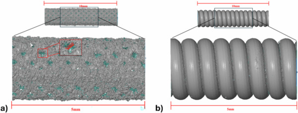 Towards biodegradable Mg-based ureteral stents: a comprehensive in vitro study of two Mg-1Y stent prototypes&nbsp; | Interventional Cardiology | Scoop.it