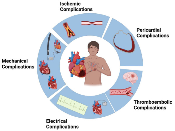 Complications in Acute Myocardial Infarction: Navigating Challenges in Diagnosis and Management | Transcatheter Treatment of Mitral Regurgitation | Scoop.it