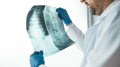 Spinal Neoplasms Diagnostic Imaging Approach Part I&nbsp;| El Paso, TX Chiropractor | Call: 915-850-0900 | Spine Health & Spinal Hygiene | Scoop.it