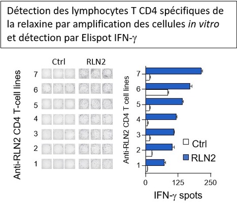 Comment une protéine du soi peut-elle être immunogène ? L’exemple de l’hormone humaine relaxine | Life Sciences Université Paris-Saclay | Scoop.it