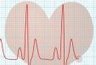 Vers une modélisation du fonctionnement du coeur | Buzz e-sante | Scoop.it
