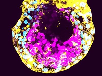Human embryo science: can the world’s regulators keep pace? | Papers | Scoop.it