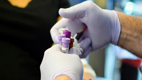 Alerte à la syphilis chez les gays : quels sont les symptômes ? – TÊTU | sida | Scoop.it